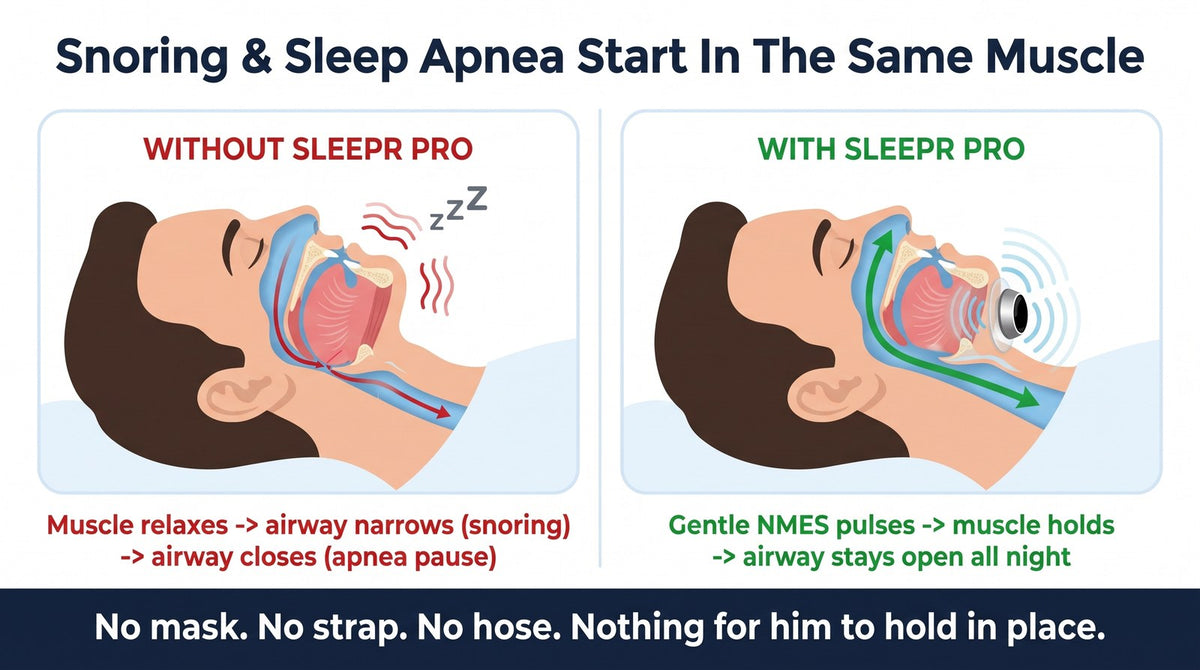 sleepr-adv3-mechanism.jpg
