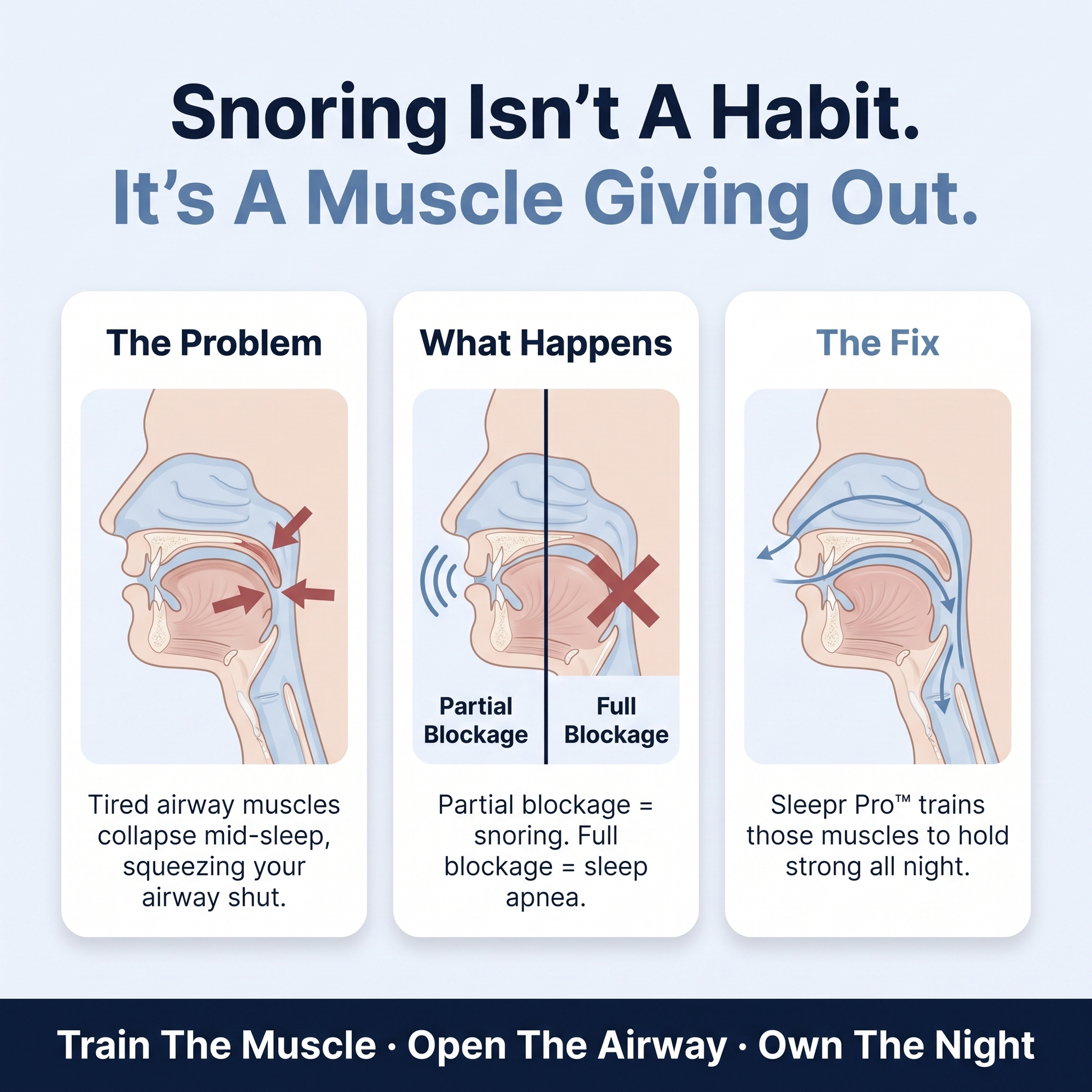 Why you snore and how Sleepr Pro fixes it - airway diagram